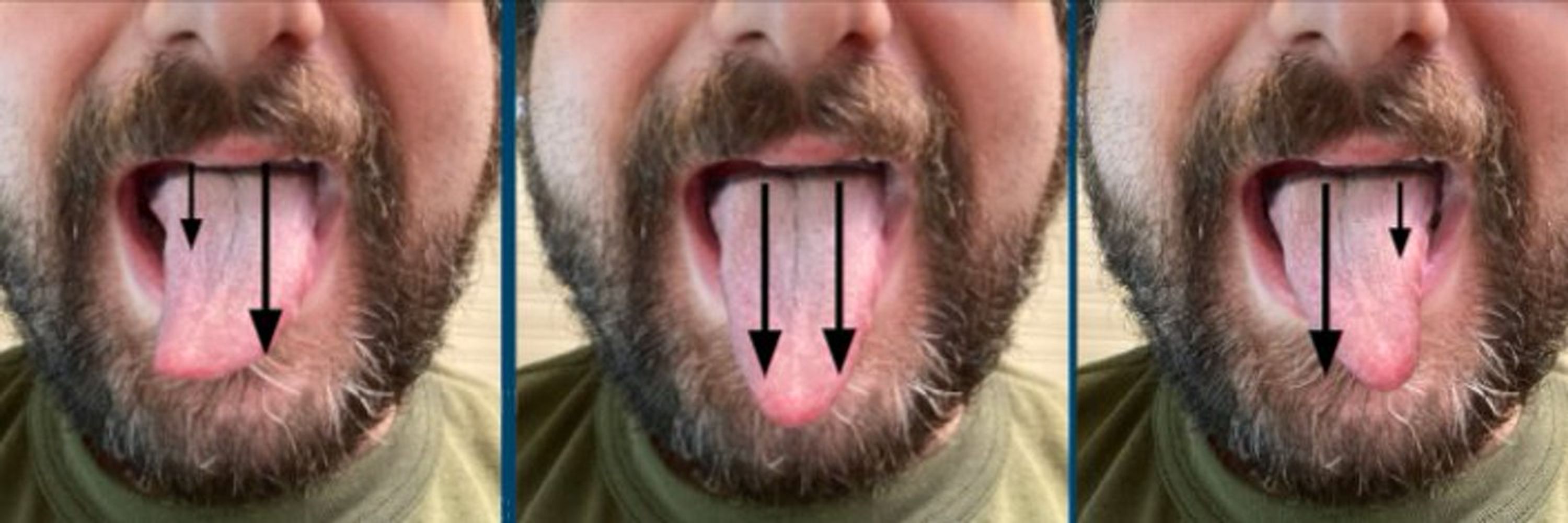 Micah Etter, MD
