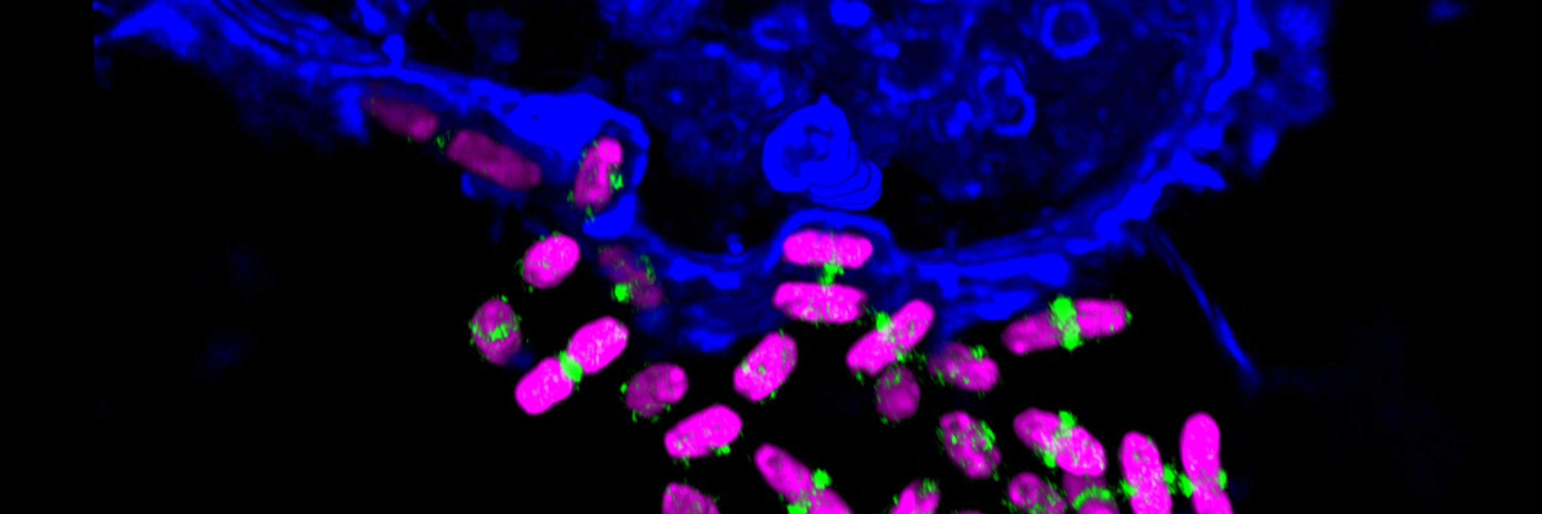 Australian Institute for Microbiology and Infection