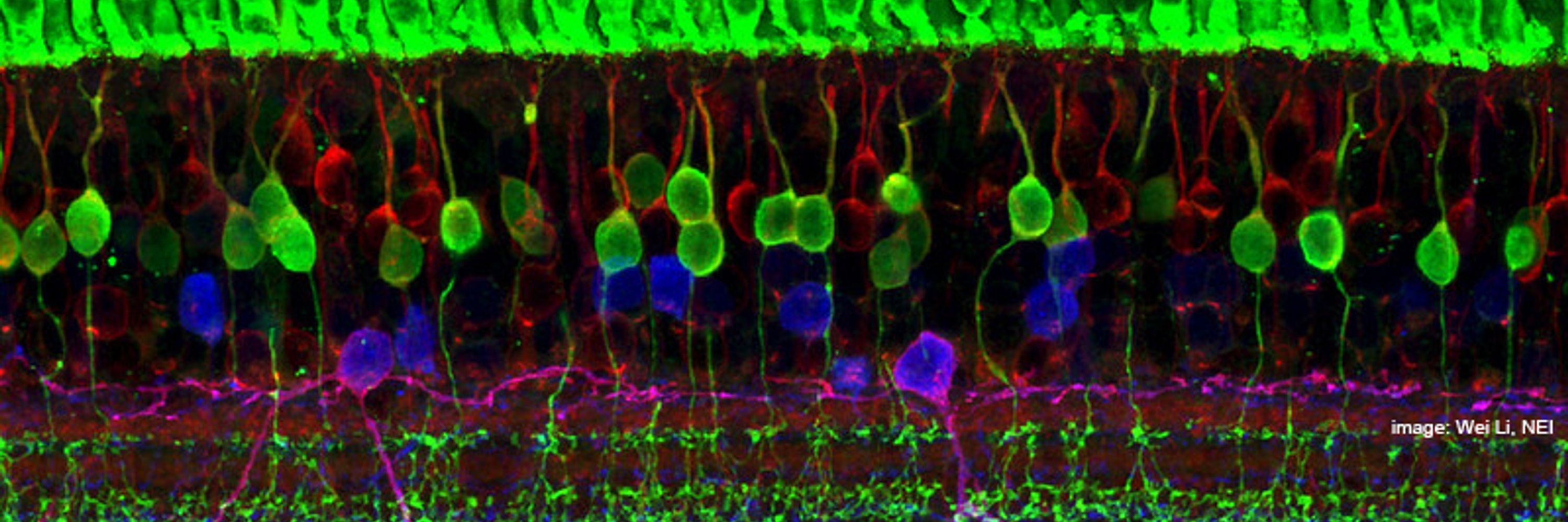 European Retinal Disease Consortium