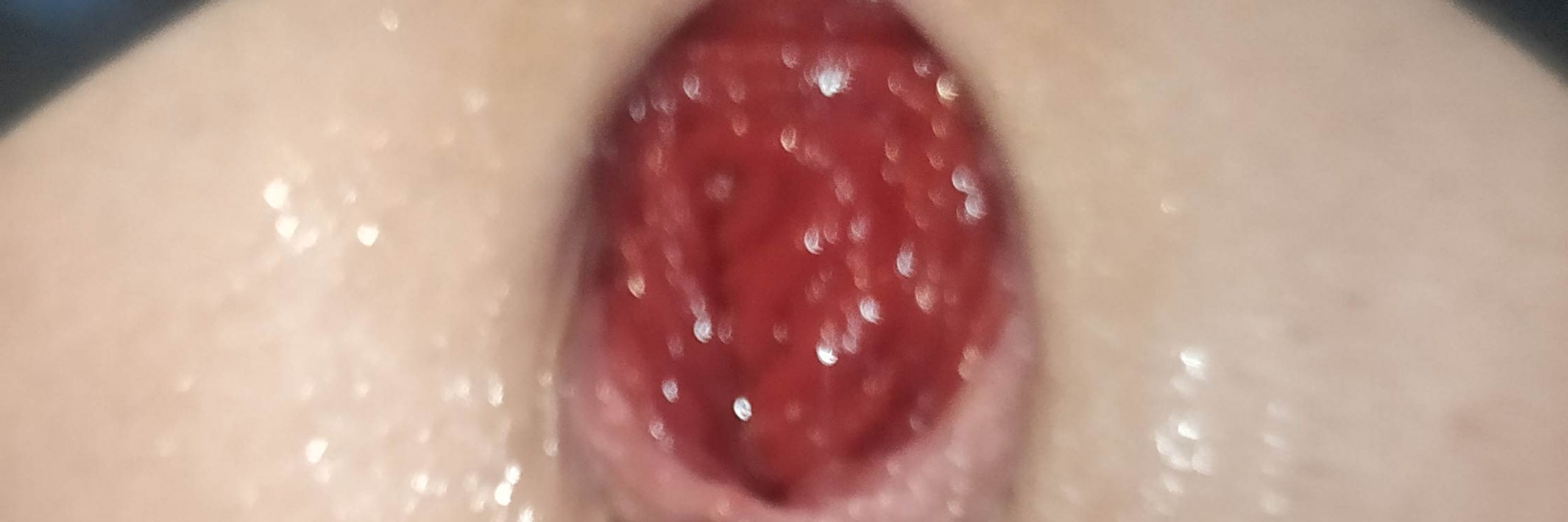 FistingRG1