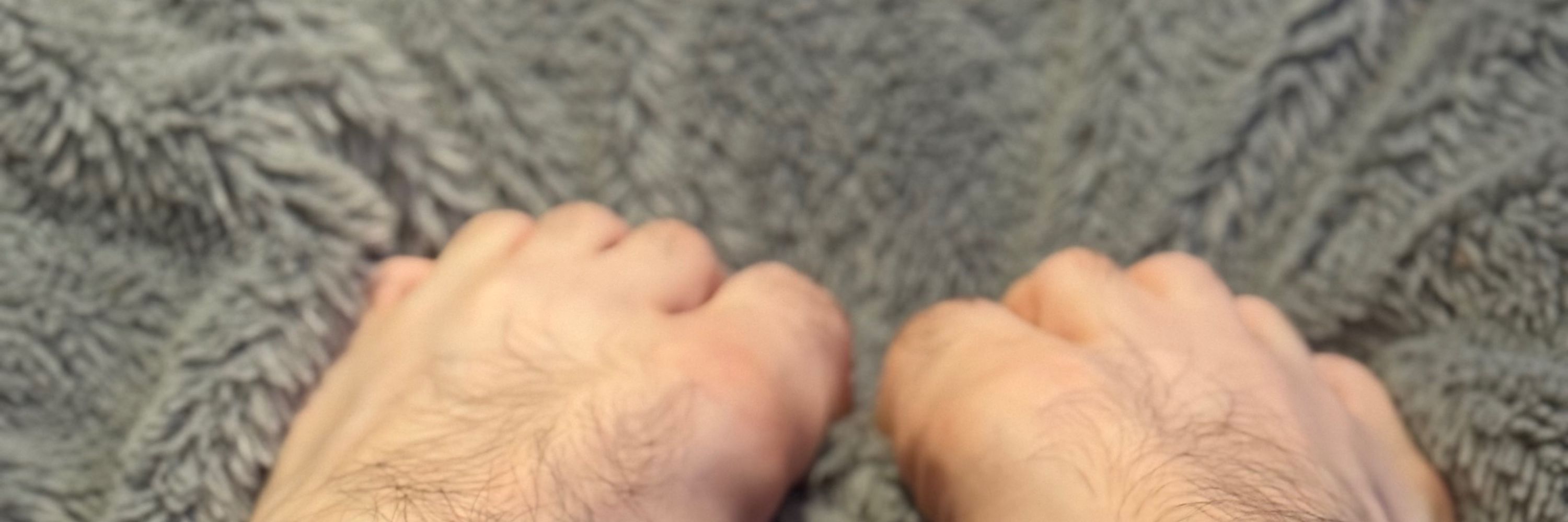 Jacks hairy feet