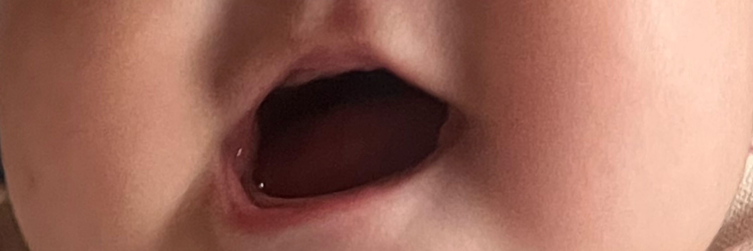 黒天