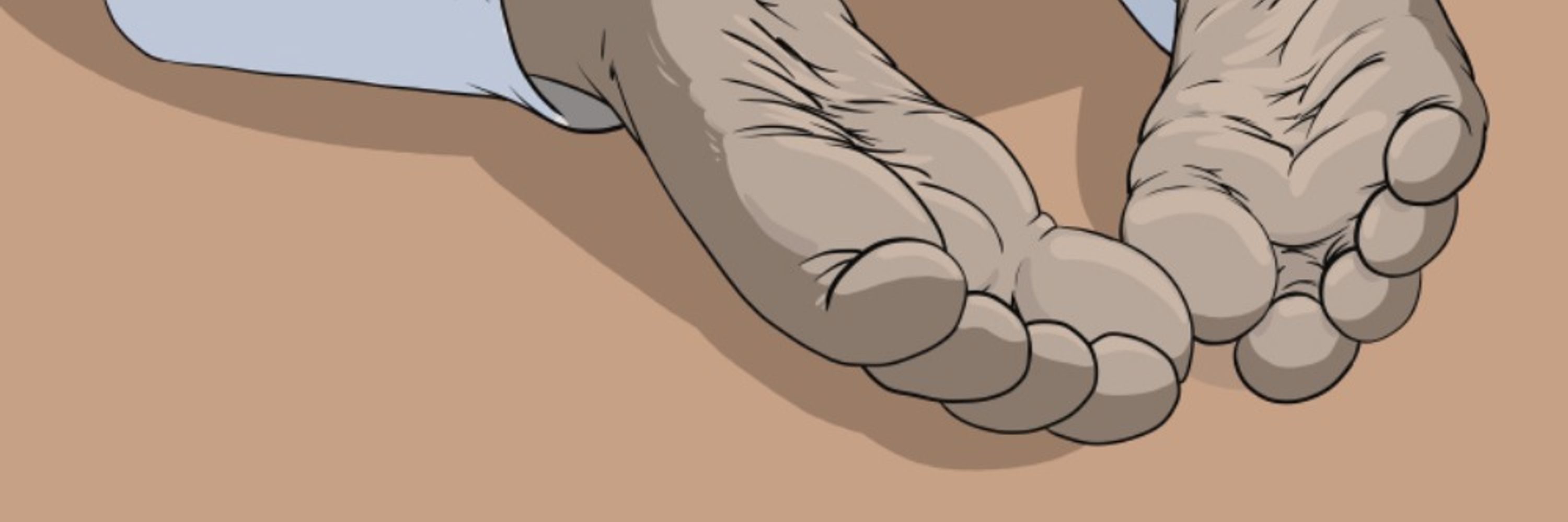 supplepawz the Vulperan pawslvt