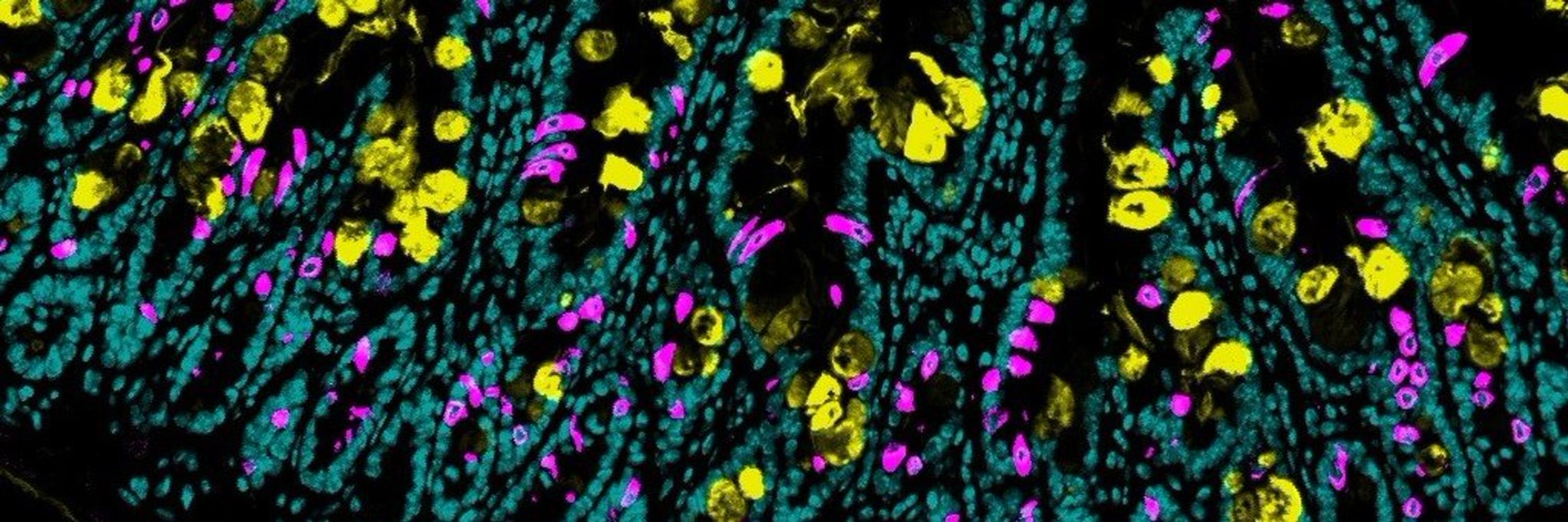 Immunolukus