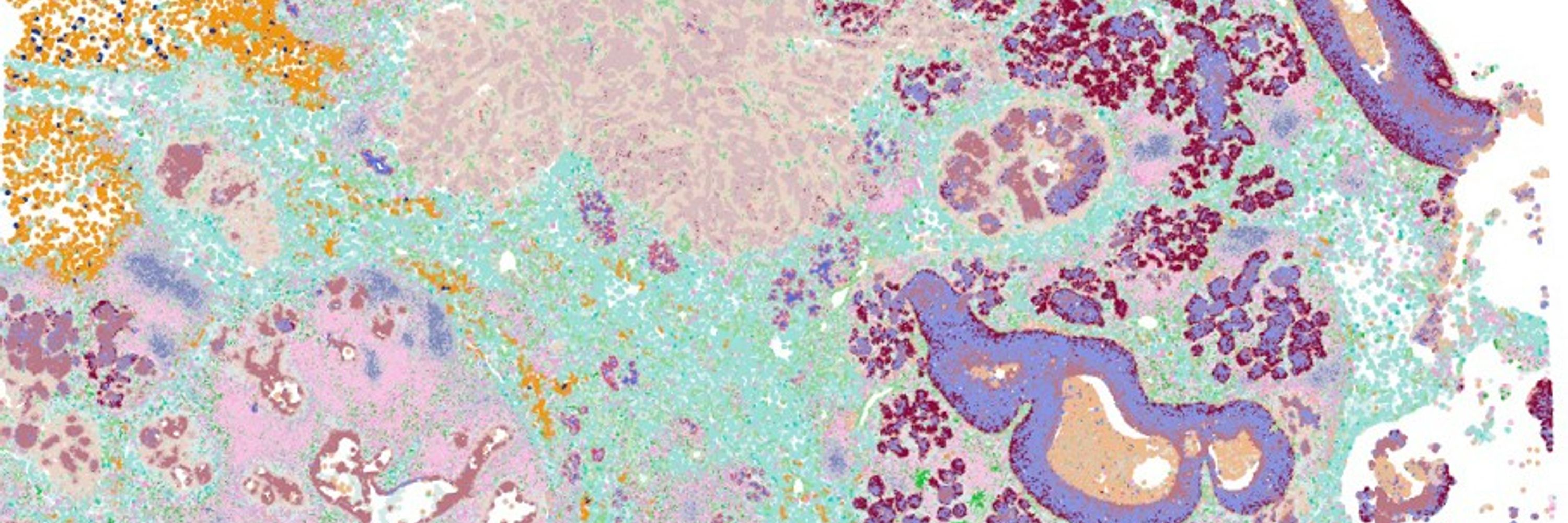 Garvan Institute Cancer Ecosystems Program