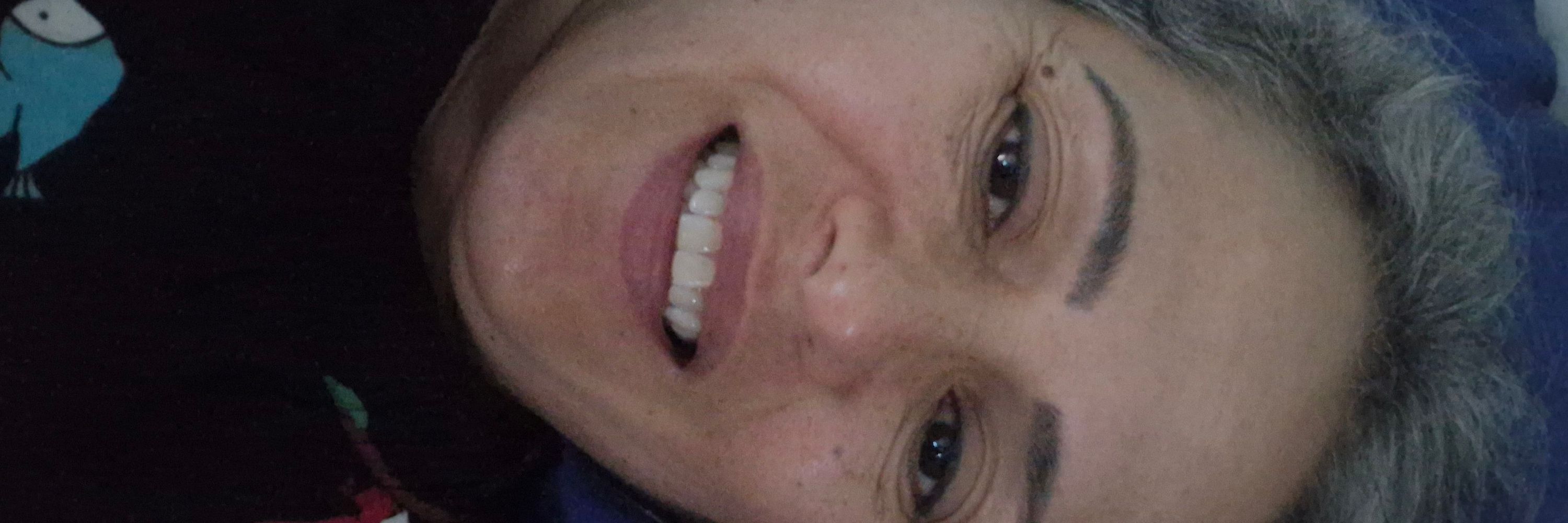 Joácida 
