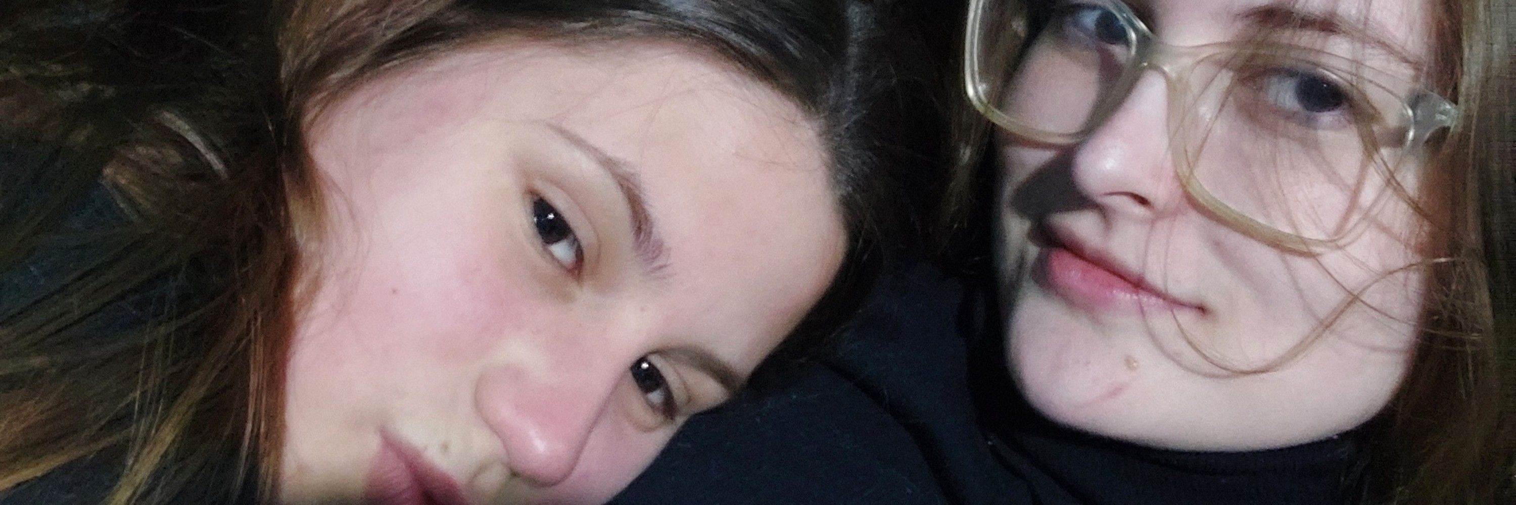 aninha (ímola)