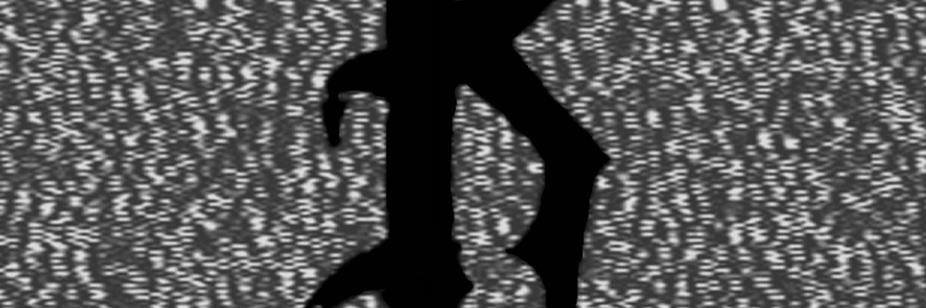 Rictus