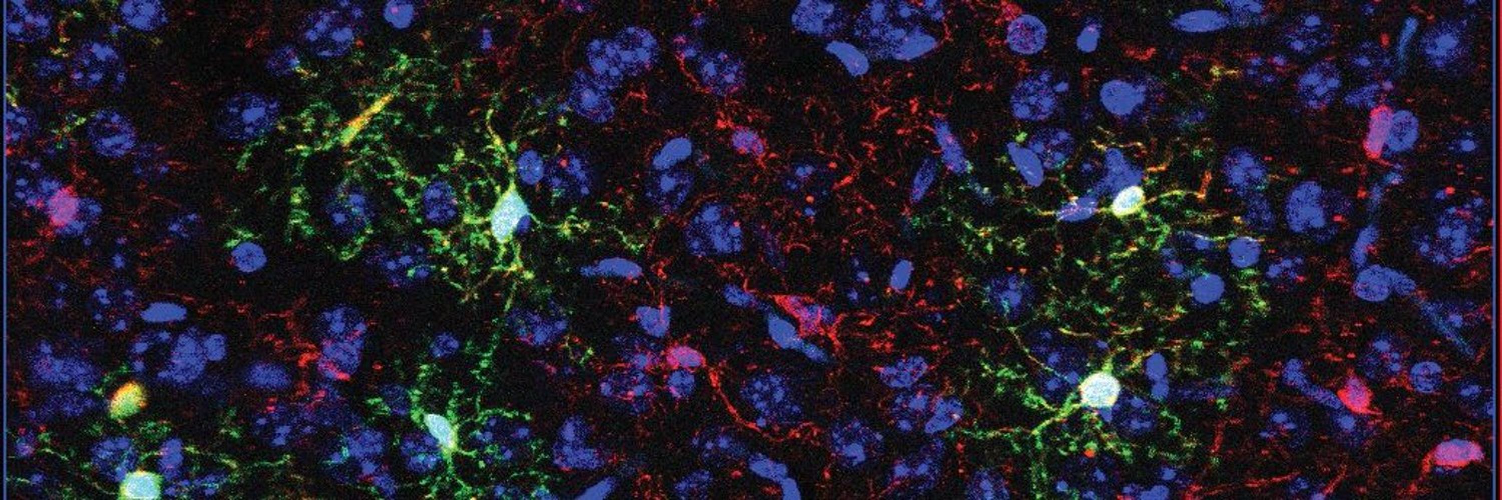 UCSF Center for Maternal-Fetal Precision Medicine