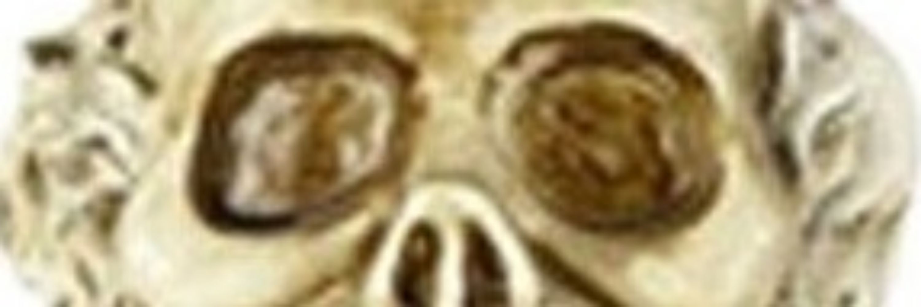 bones