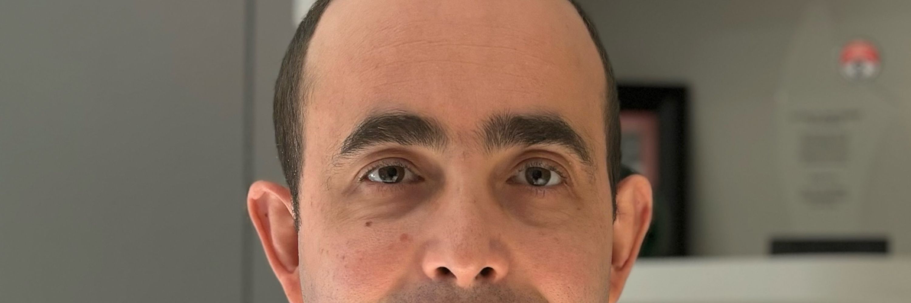 MD Prof Yusuf Yildirim, FEBO, FİCO Istanbul Medipol University