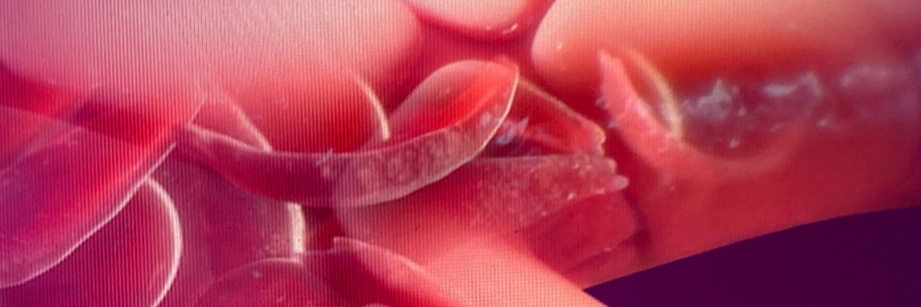 DrZSickleCell