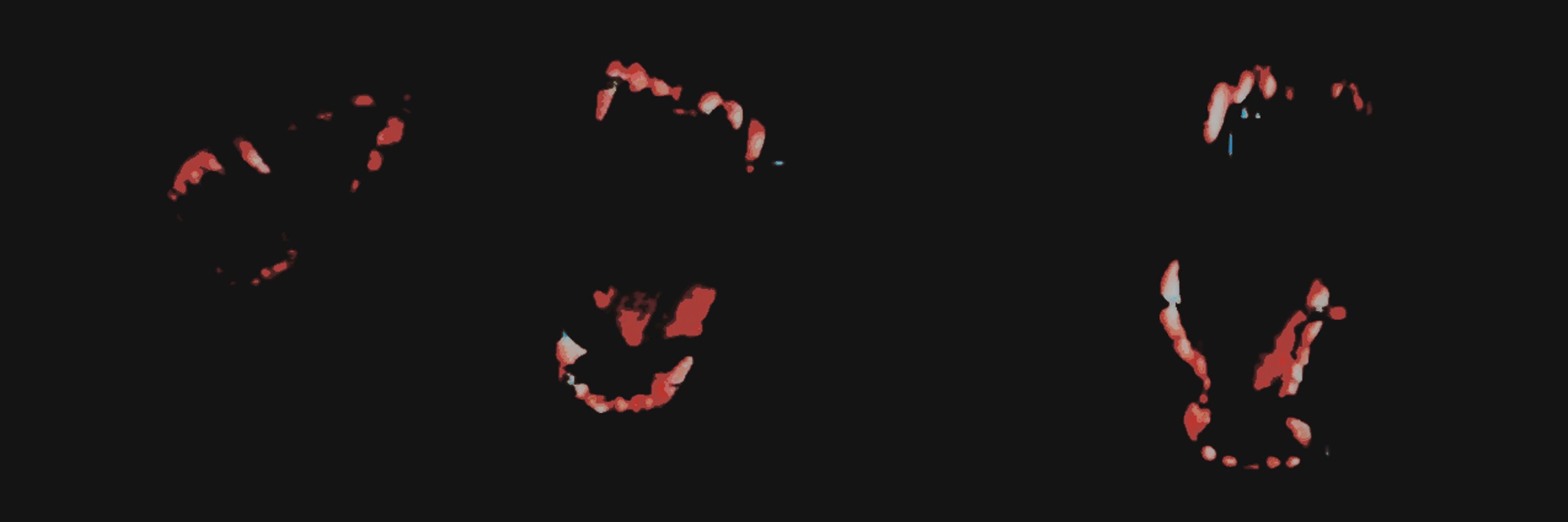 DOG  BITE   ╱   CANINE  SPITE .ᐟ