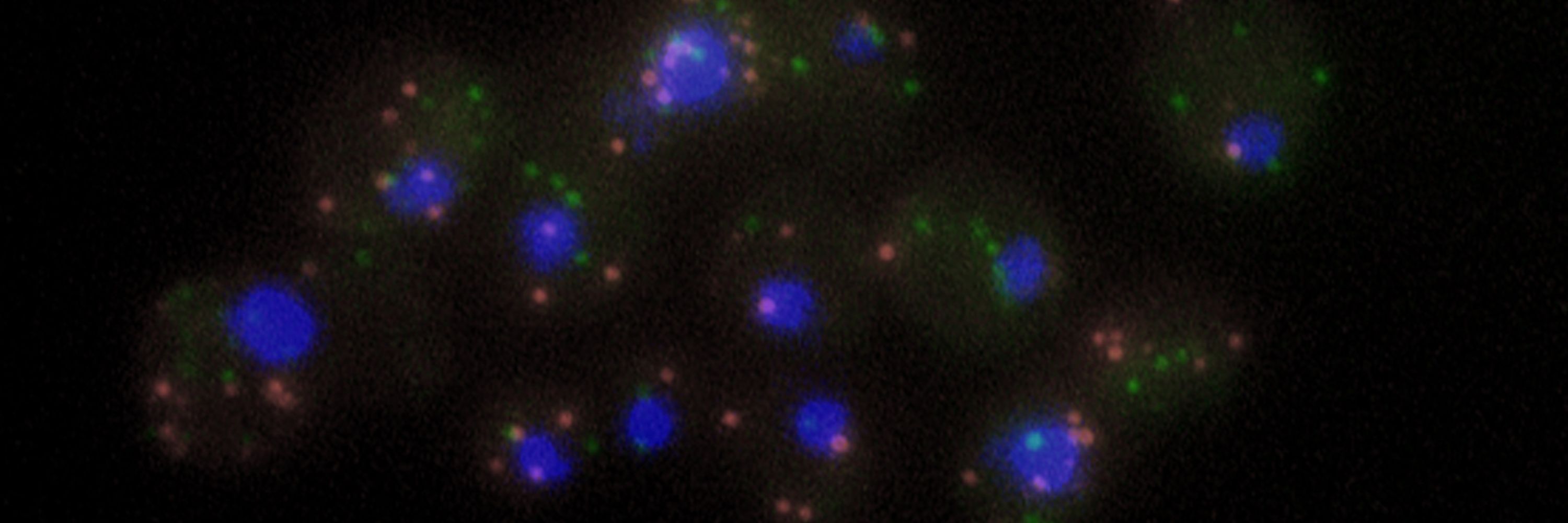 Palancade lab