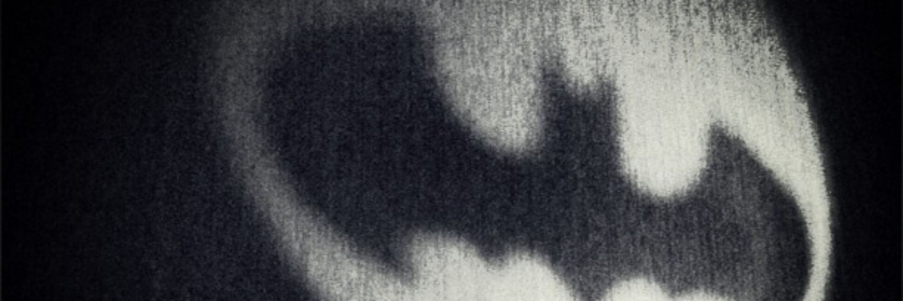 🦇