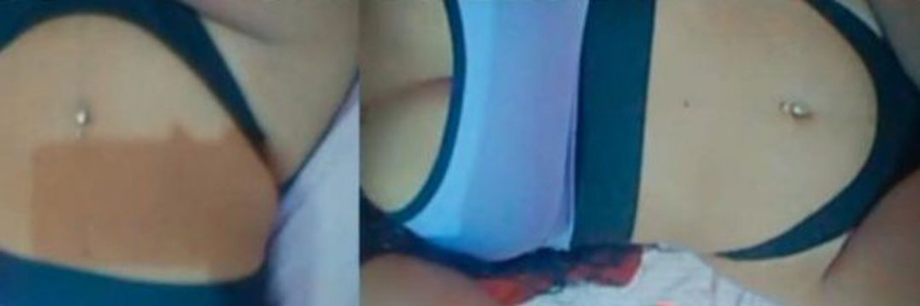 Nati