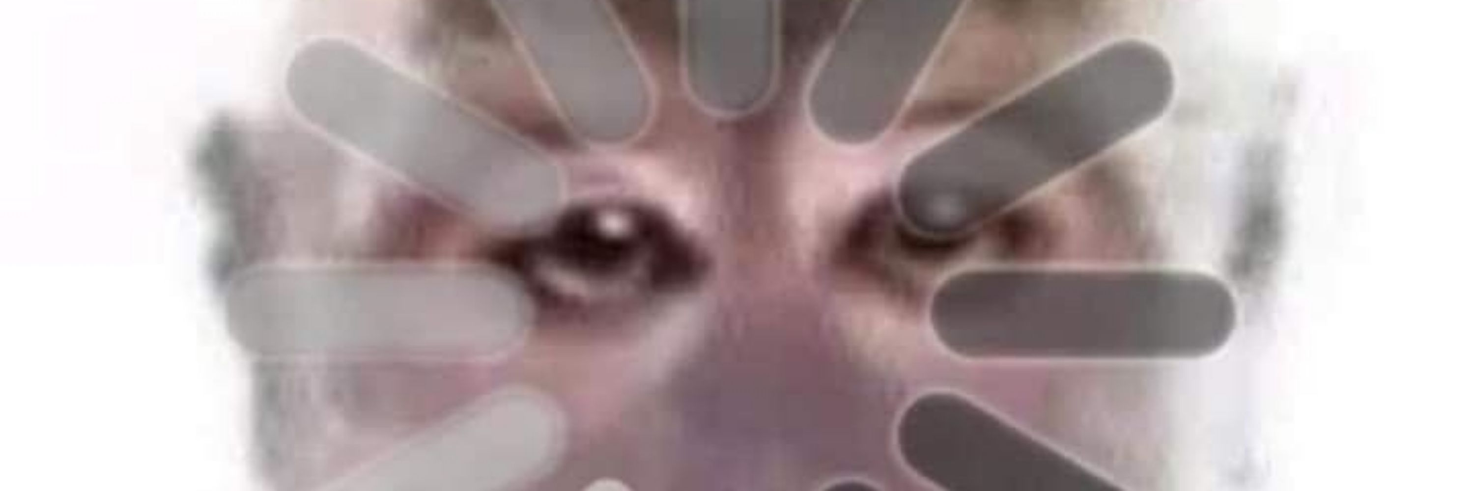 dysmek