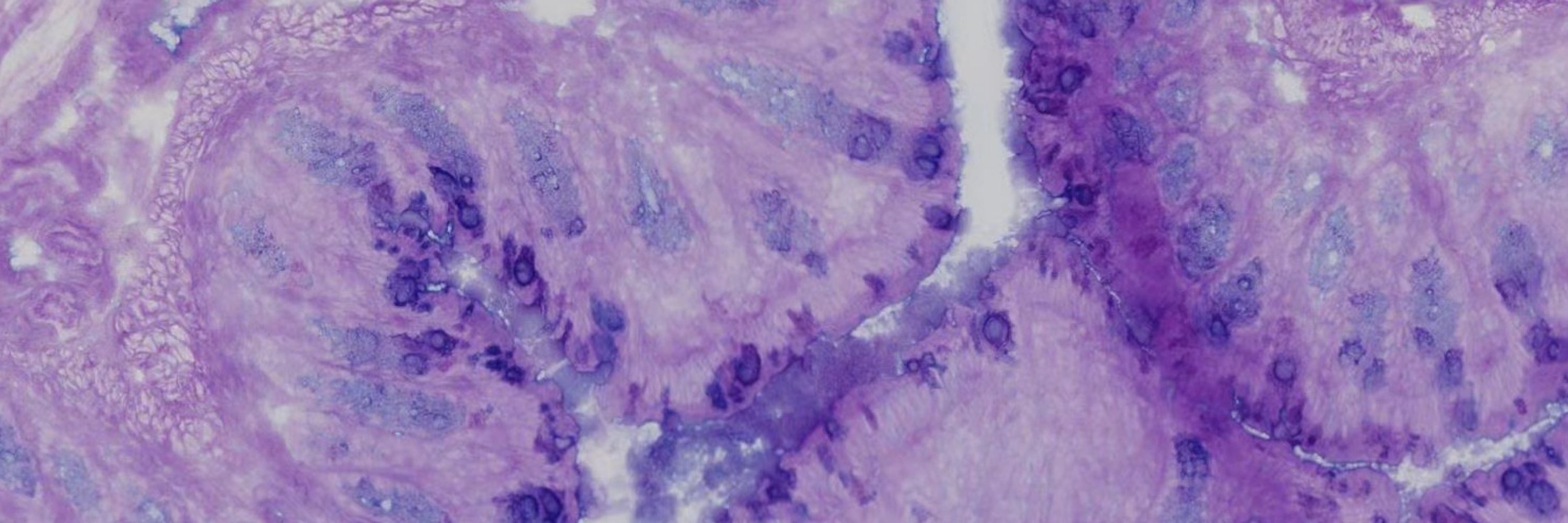 UNC Microbiome Core