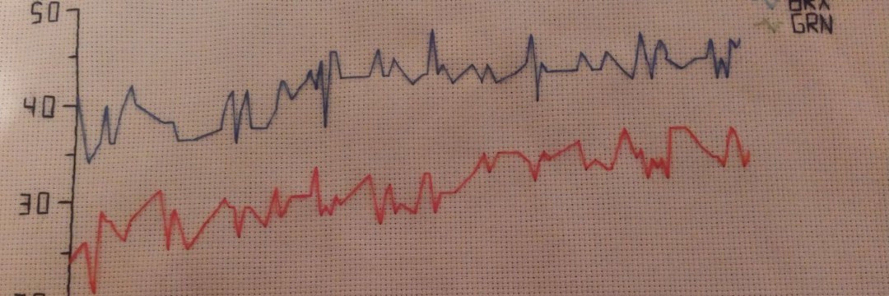 Statistitching
