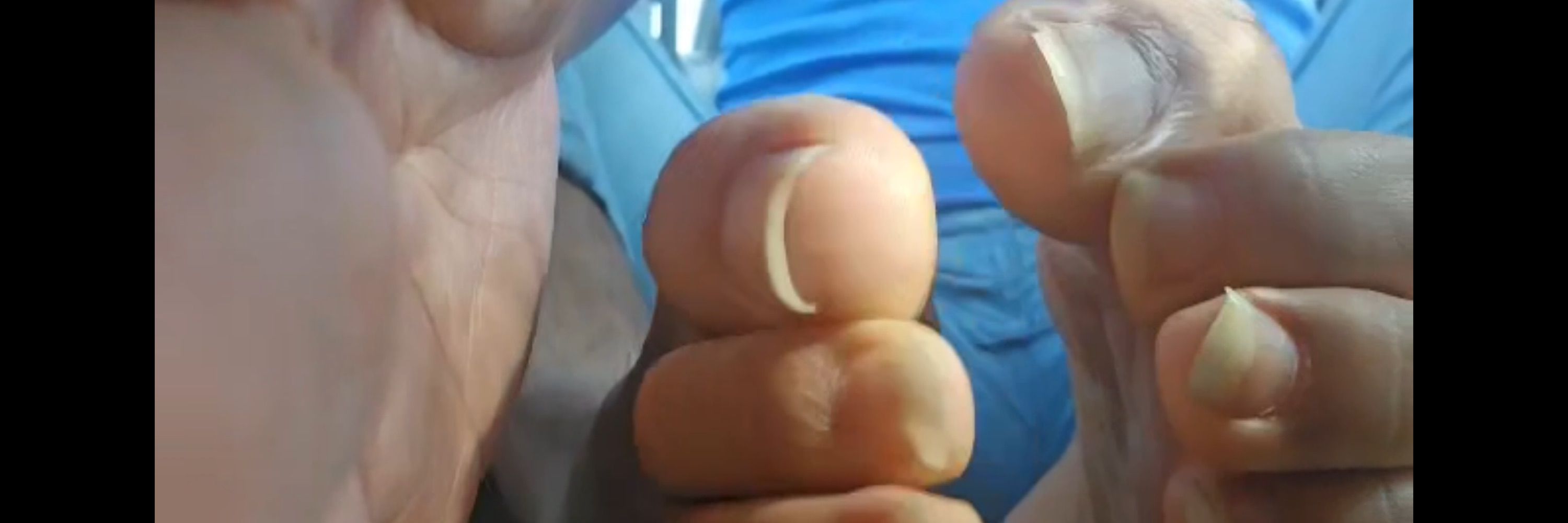 ChocoSix Bator