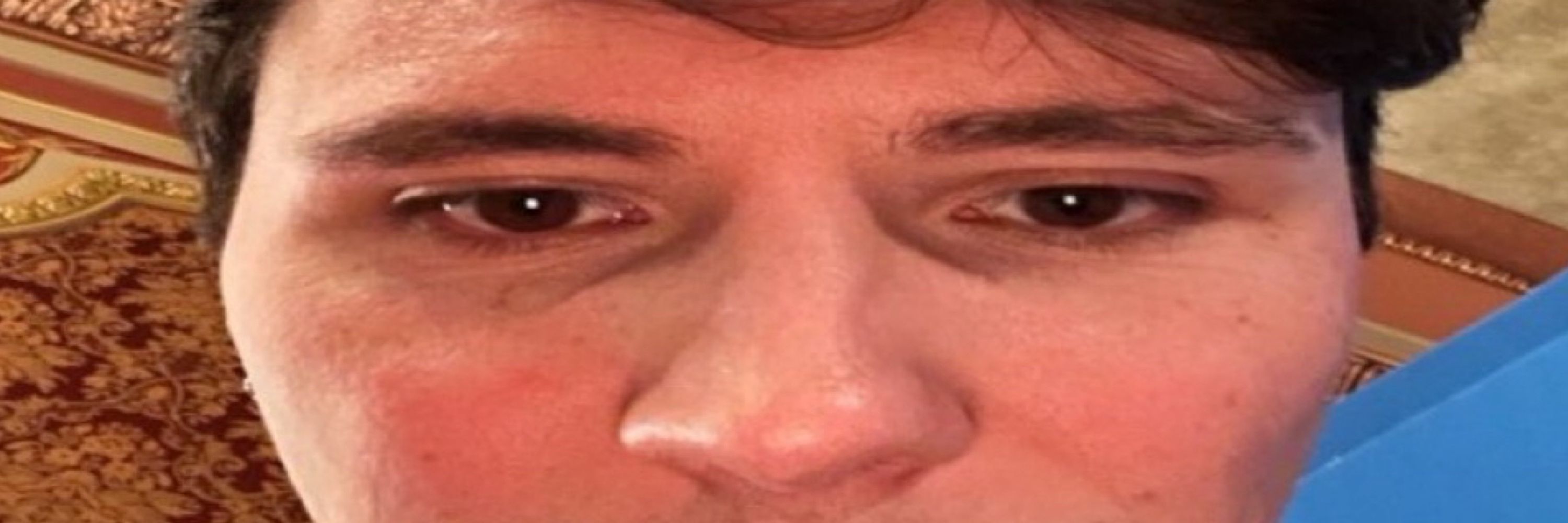 myles IS MEETING DNP