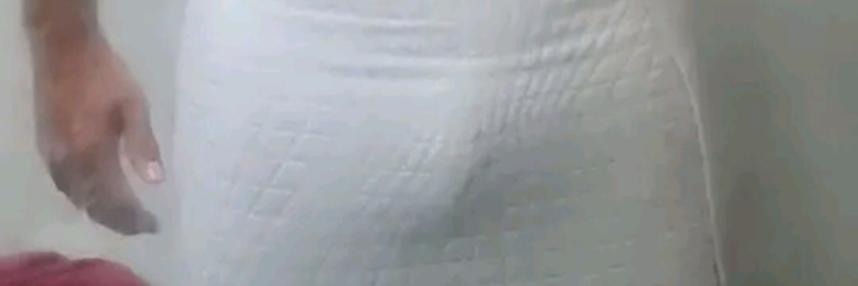MachooGyn