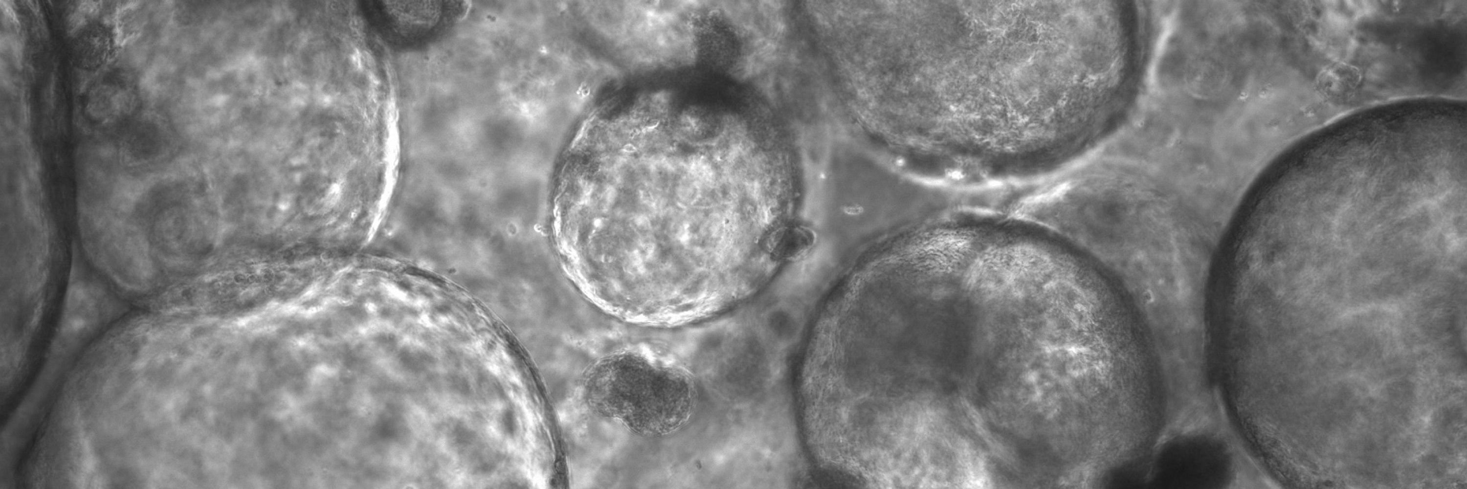 Carola Voss - OrganoidTox Lab