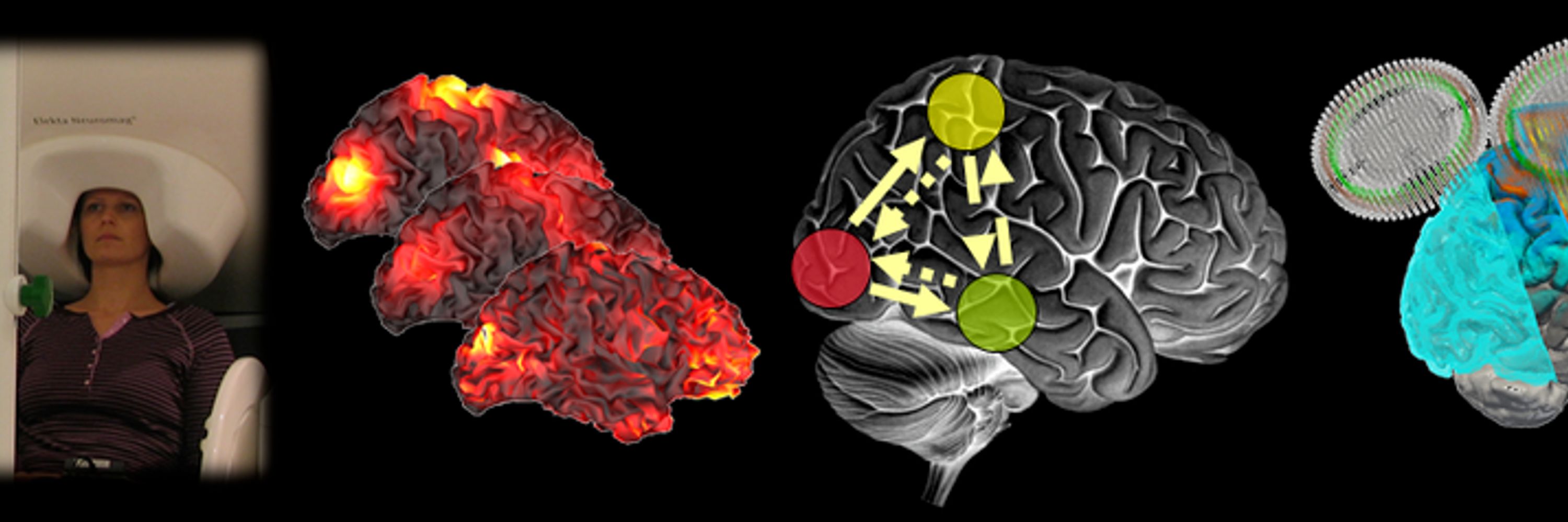 Brain Networks