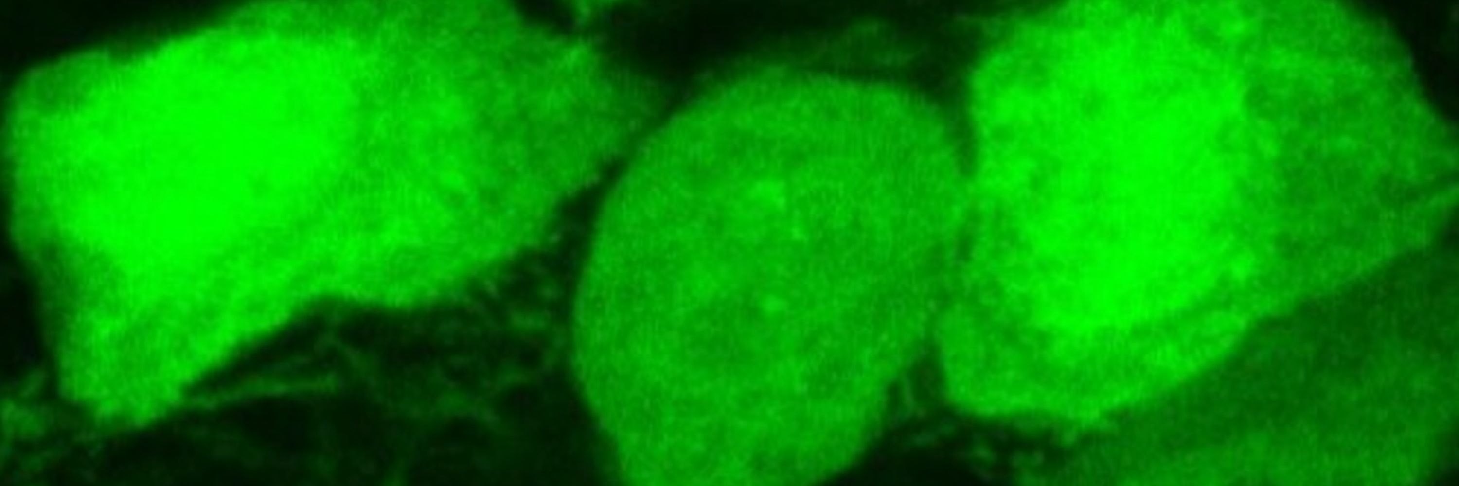 KLAB - finding a cure for GI dysmotility at #HarvardStrong
