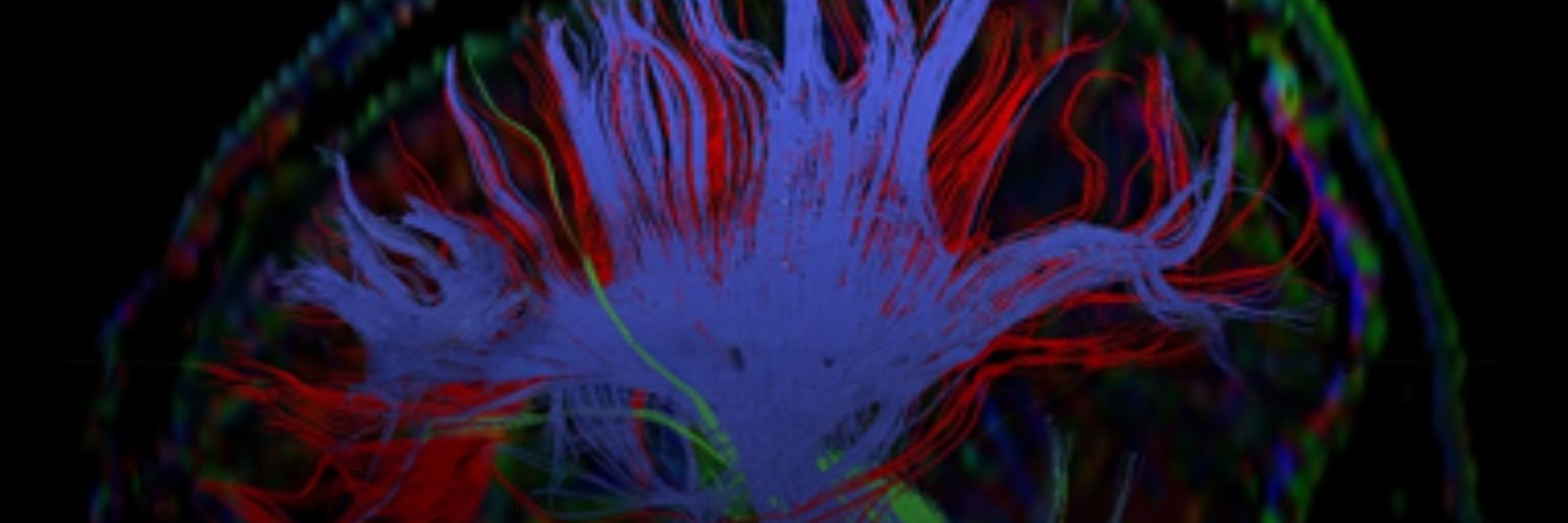 National Center for MRI Biomarker @ Kennedy Krieger Institute
