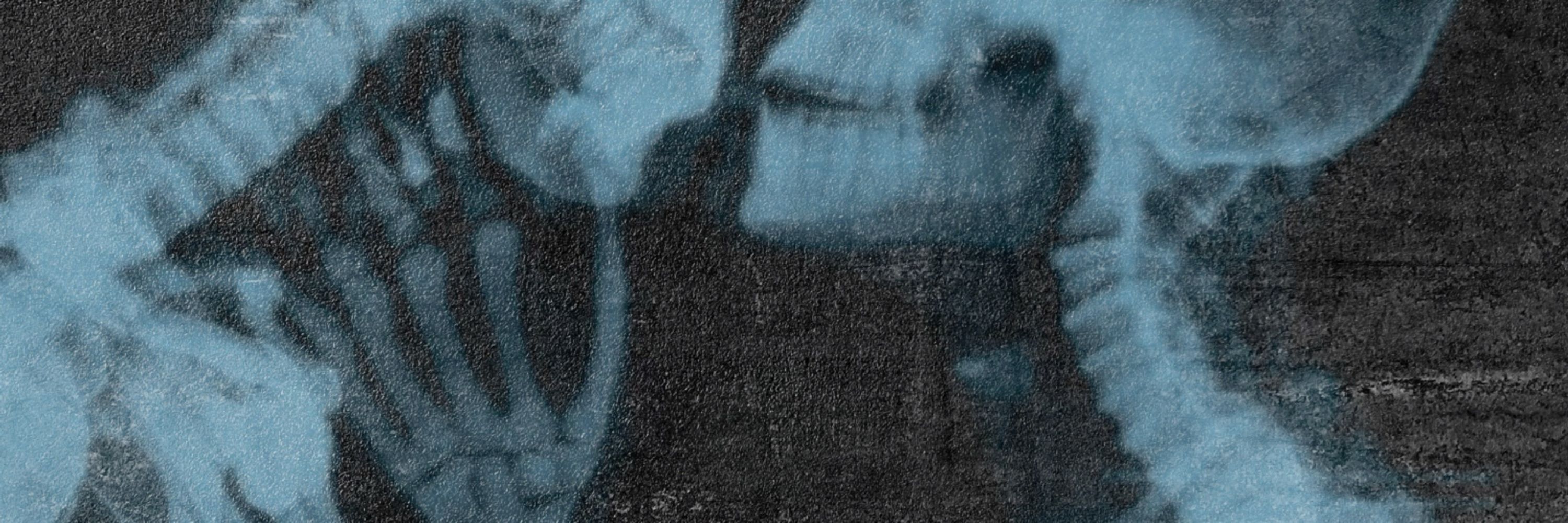 ᴅʀ. ʜᴇᴀʀᴛ sᴛᴇᴀʟᴇʀ.