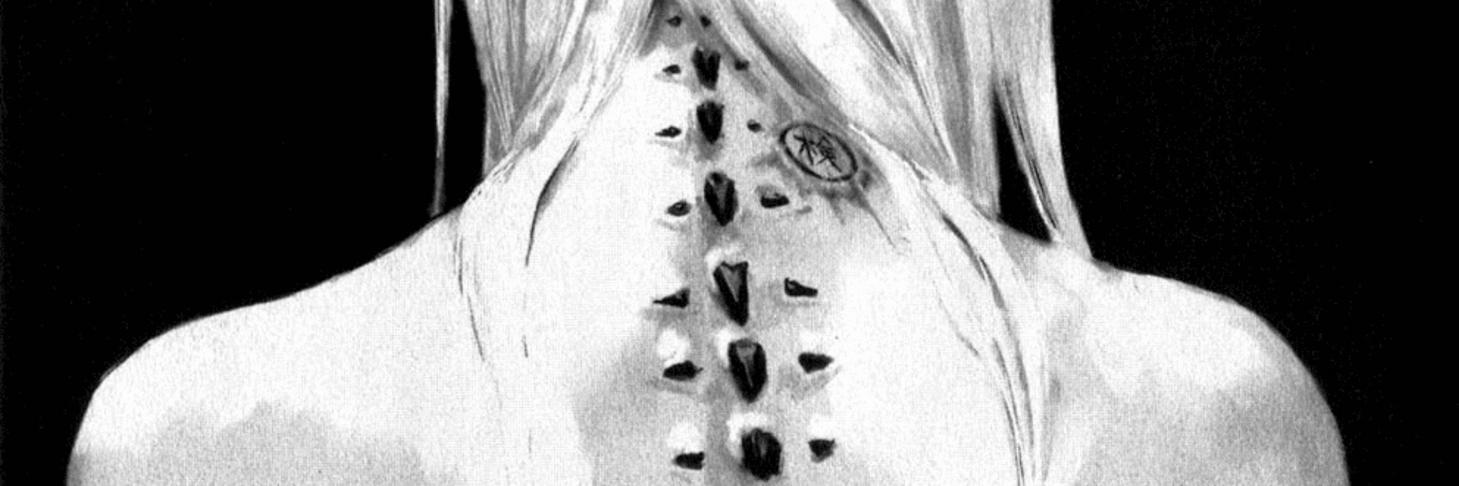 lesions