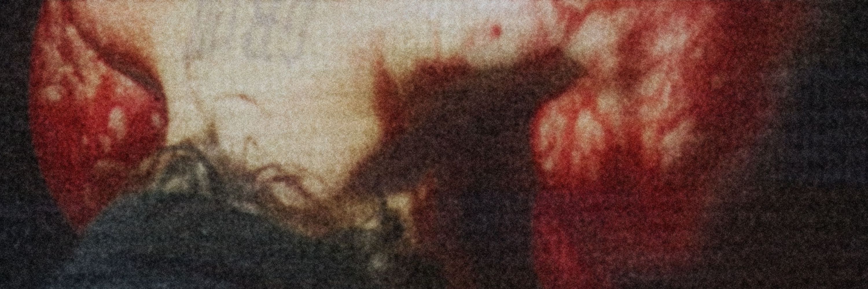 STVG