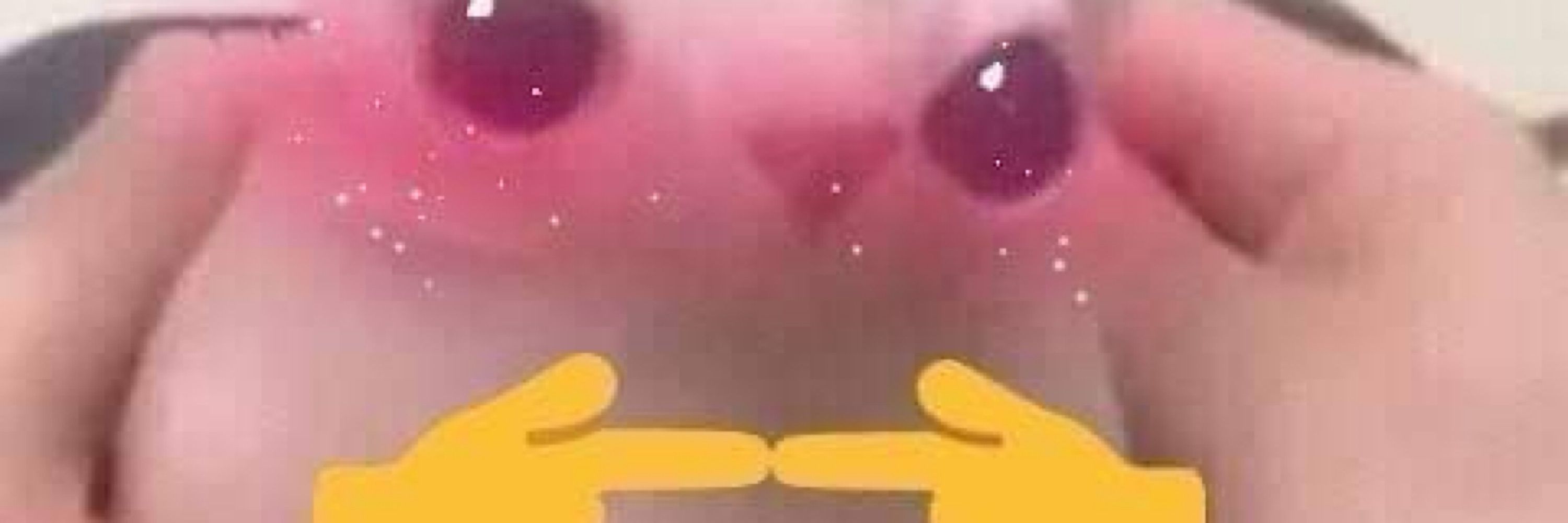Is a dora