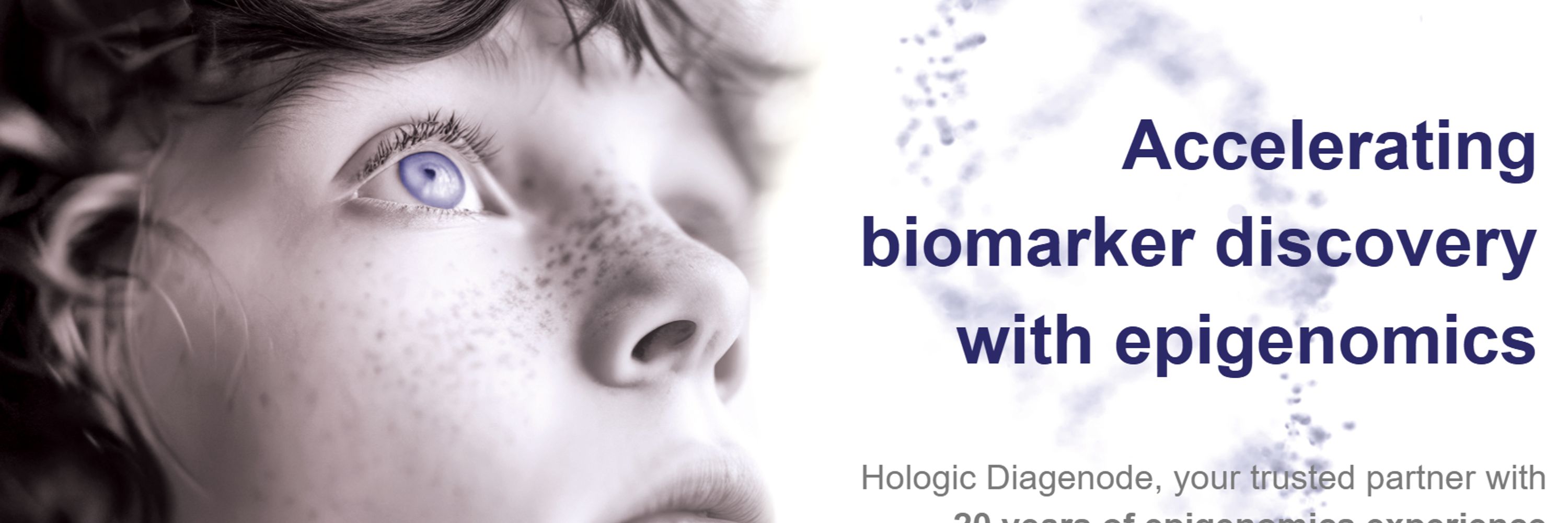 Hologic Diagenode