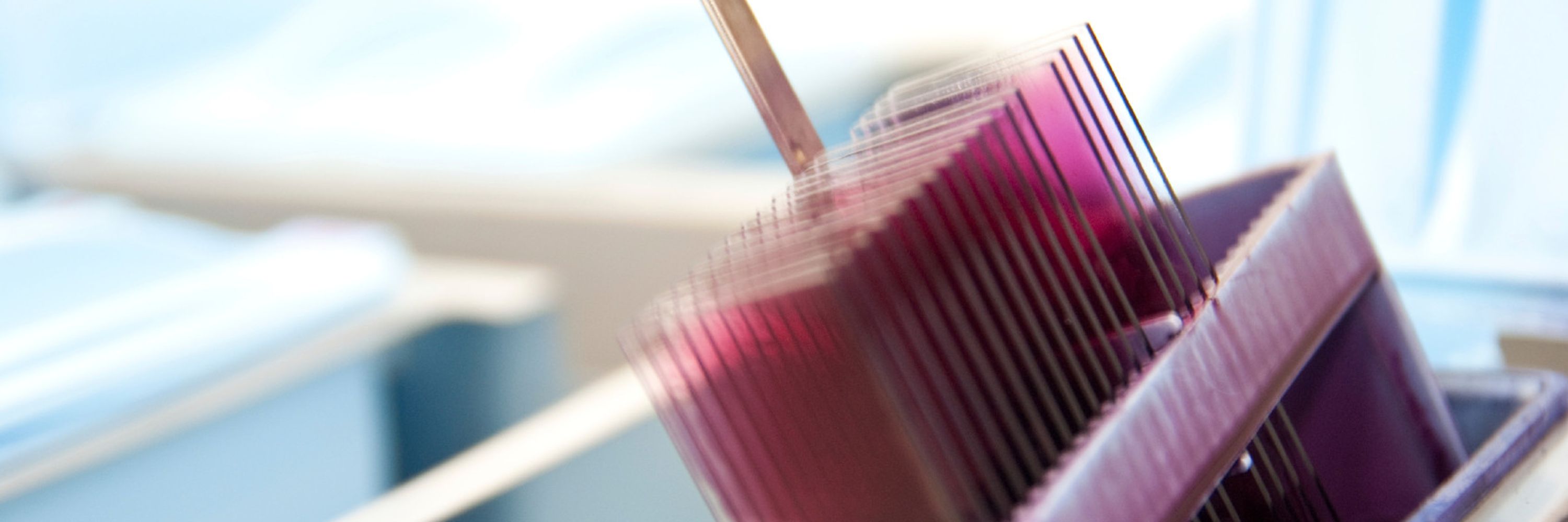 Molecular Breast Pathology Lab