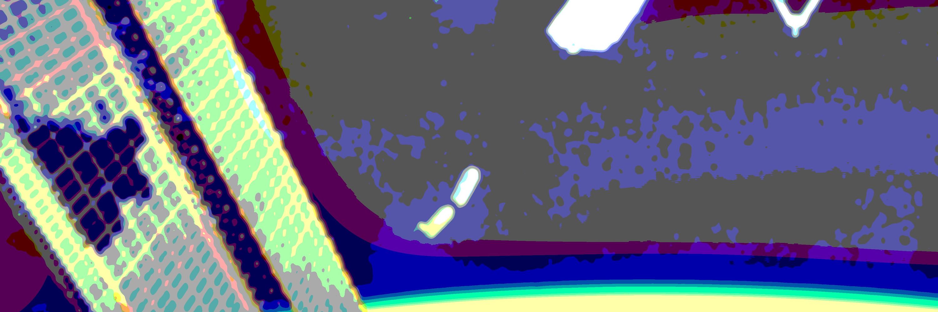 tranxxeno lab
