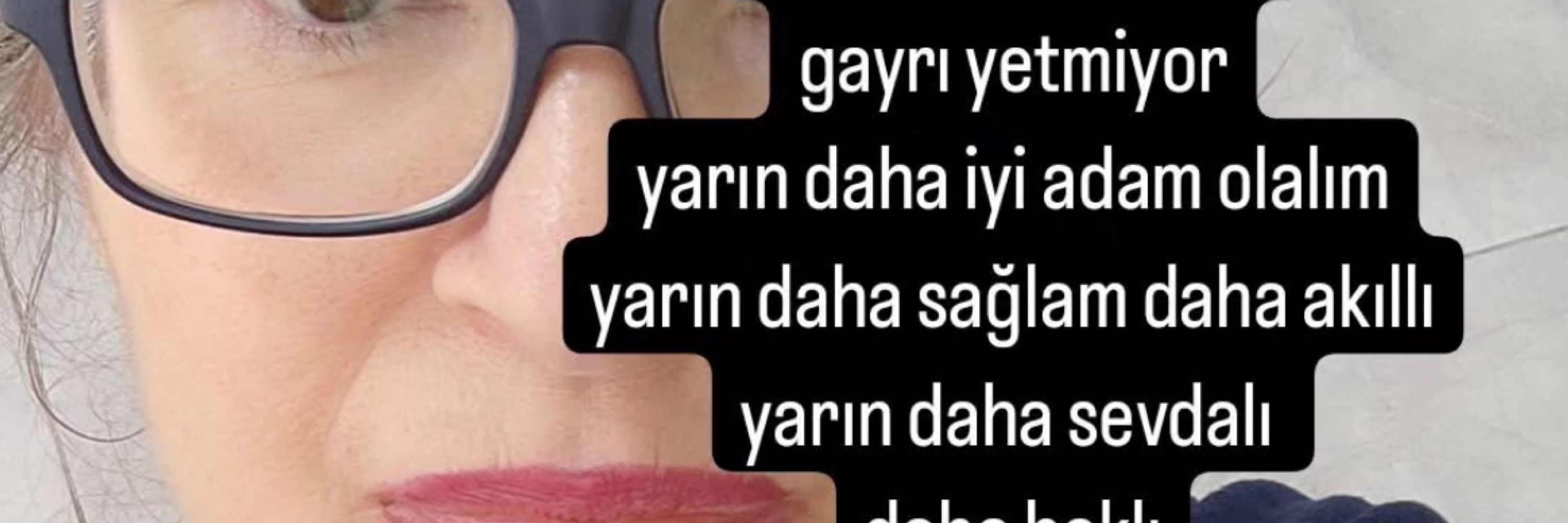 Dilek A.