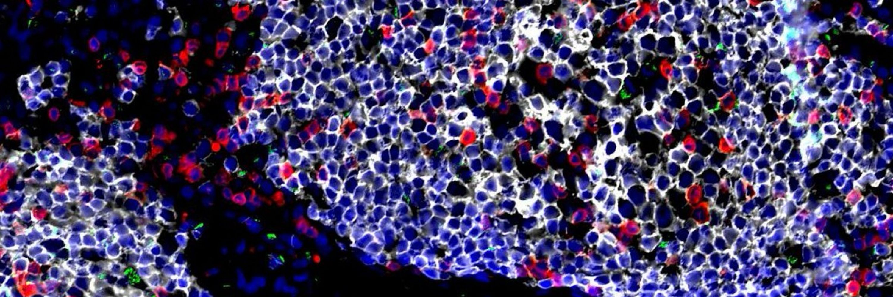 Host Microbe interactions