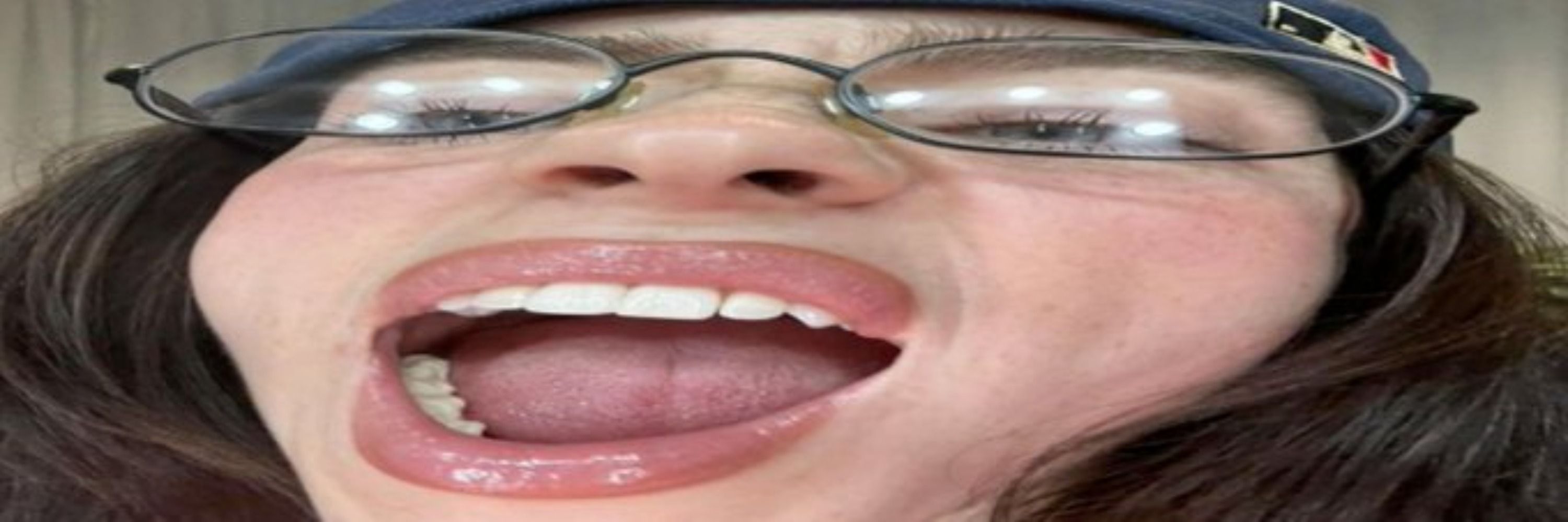 mzfra