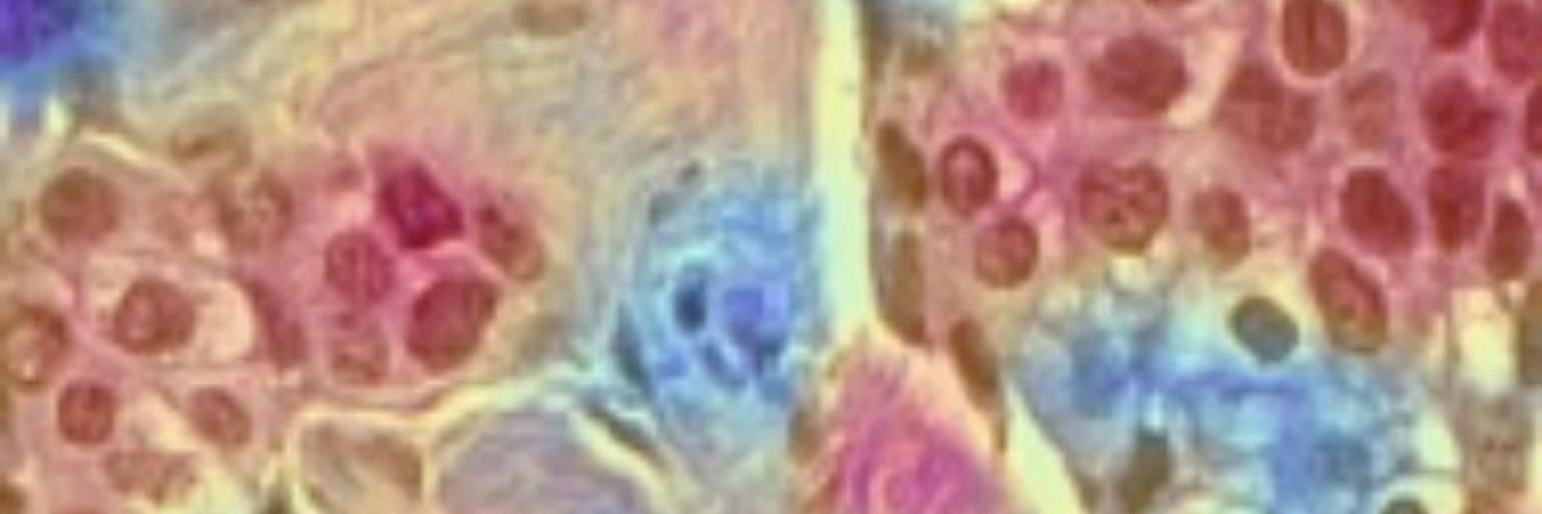 The American Journal of Pathology