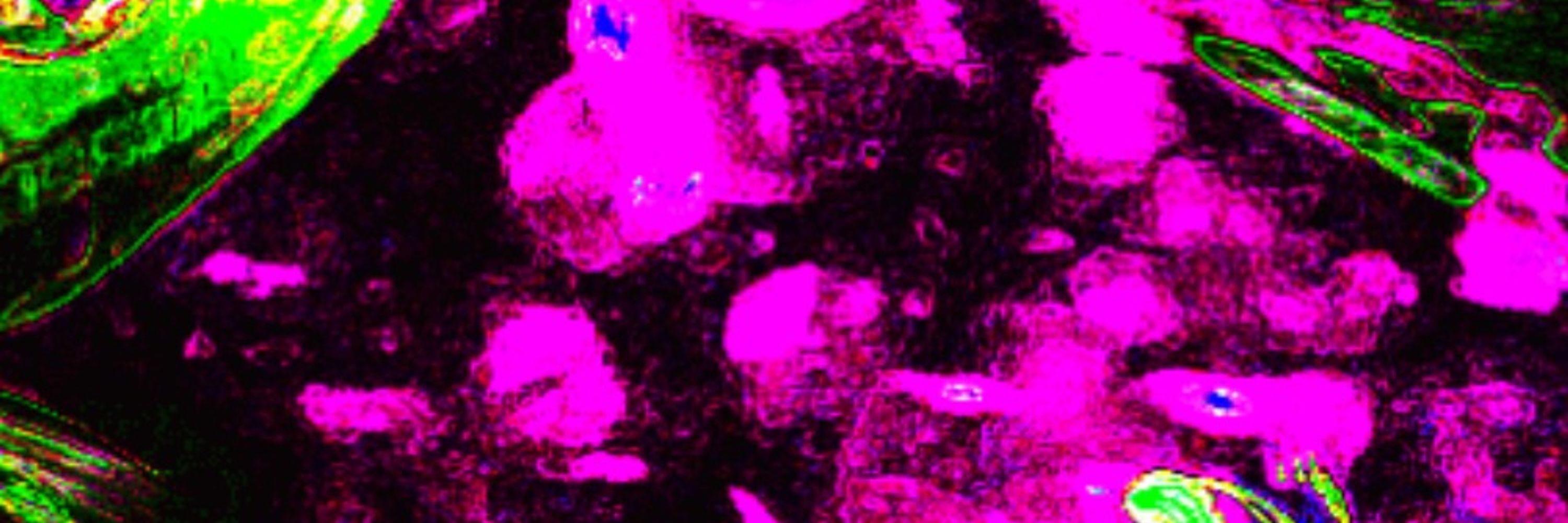 jester