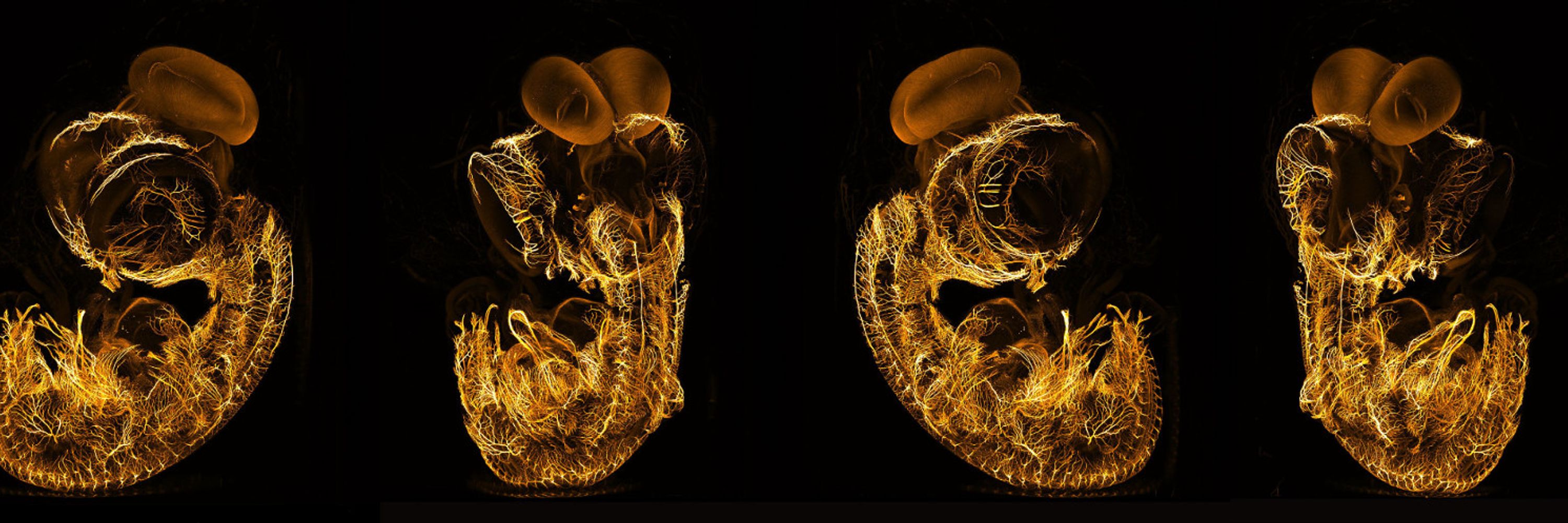 mesoSPIM: Clear Images. Big samples. Open source.