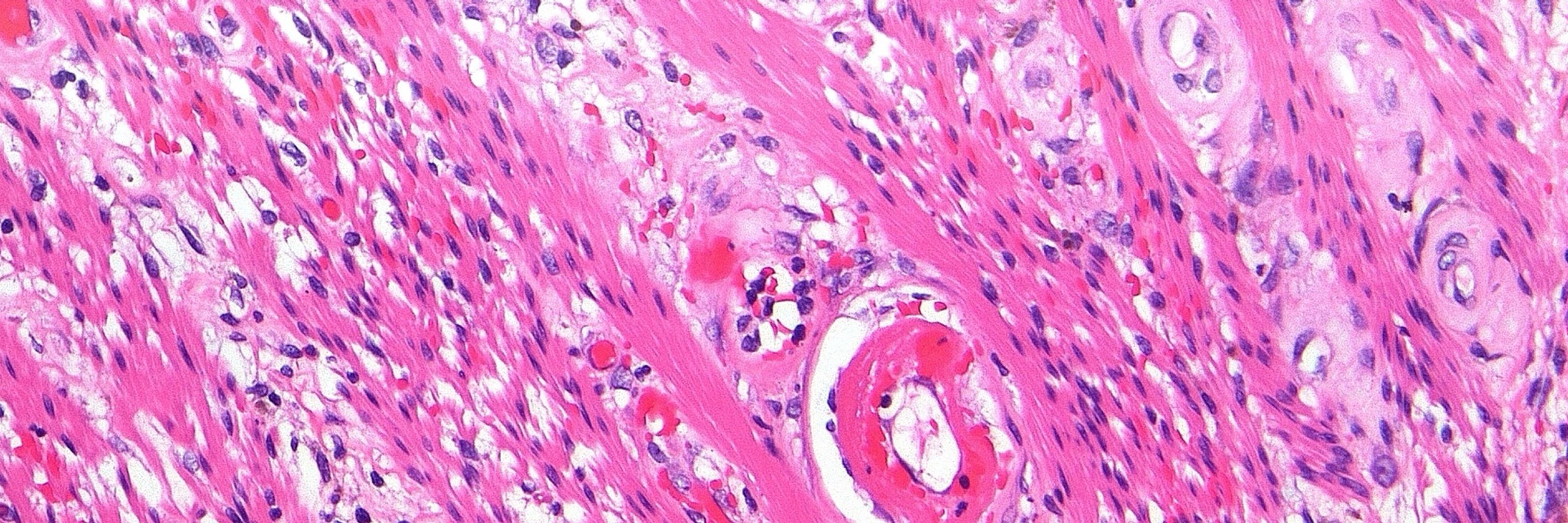 Genes, Society & Disease