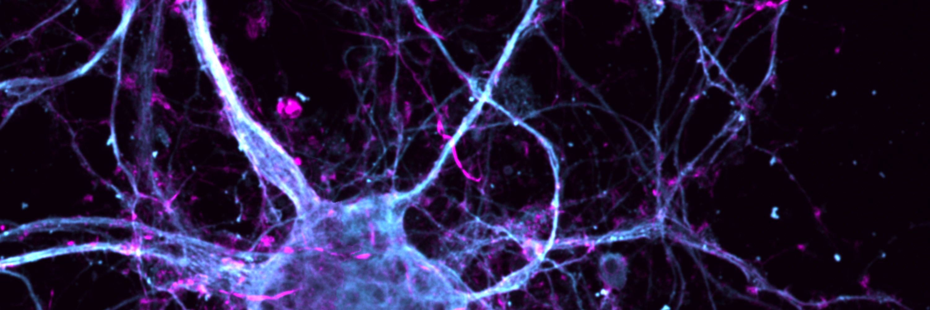 Institute for Psychedelics and Neurotherapeutics