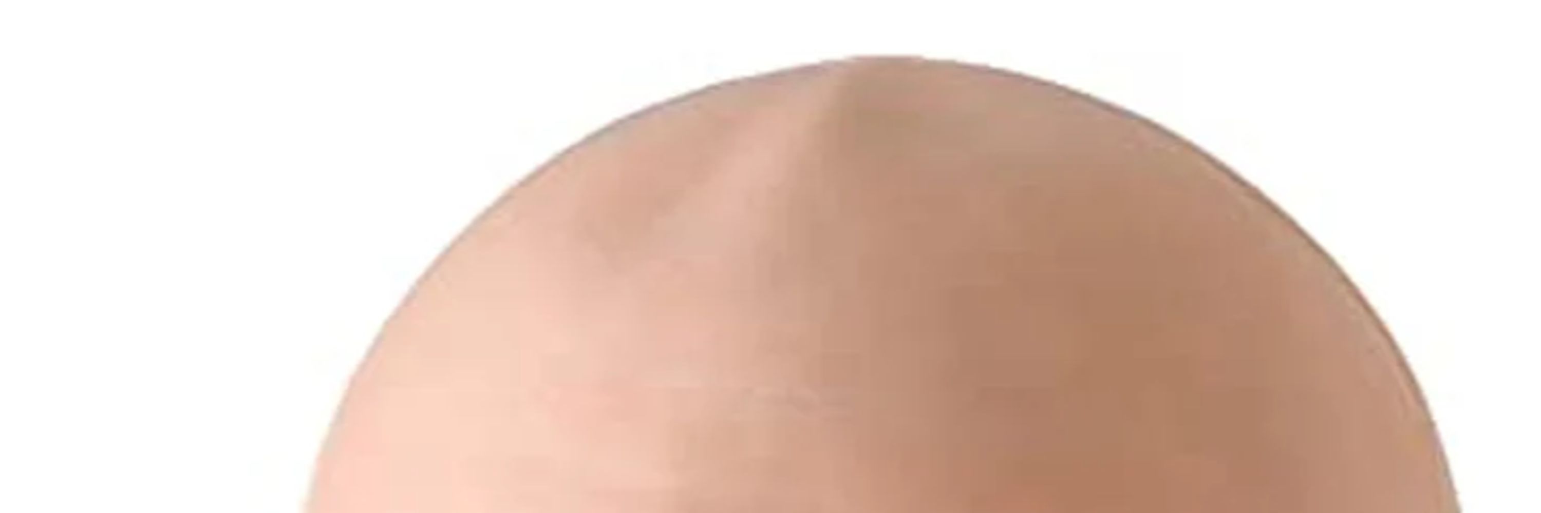 Toadbald