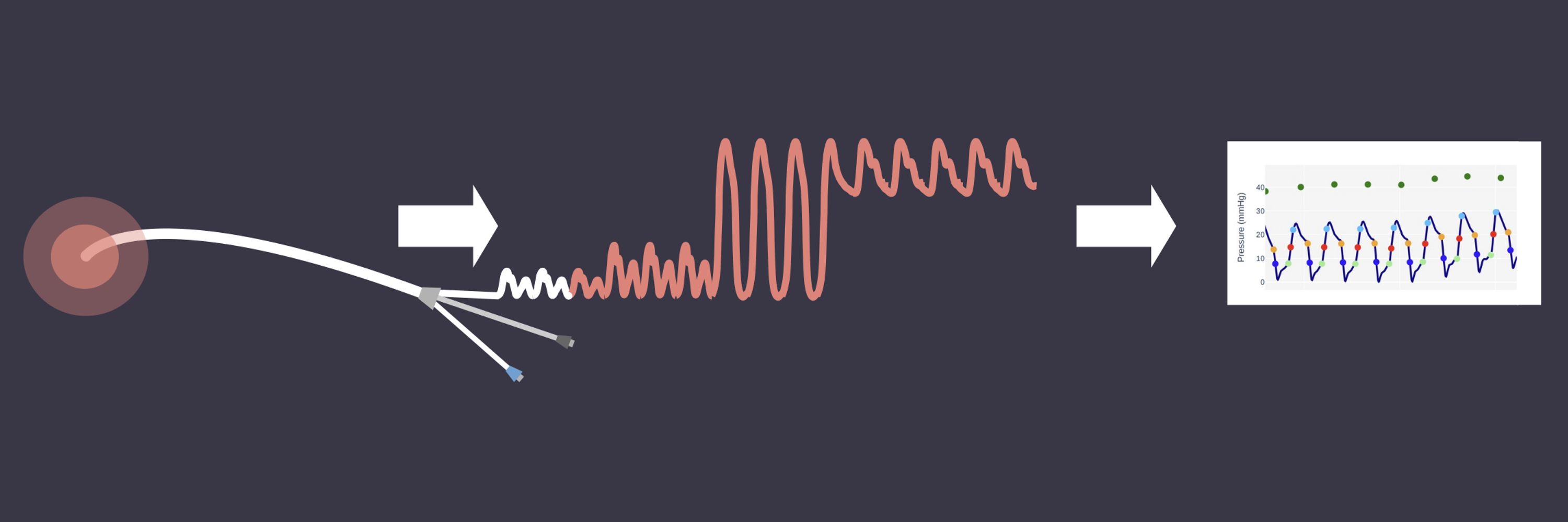 Hemodynamix