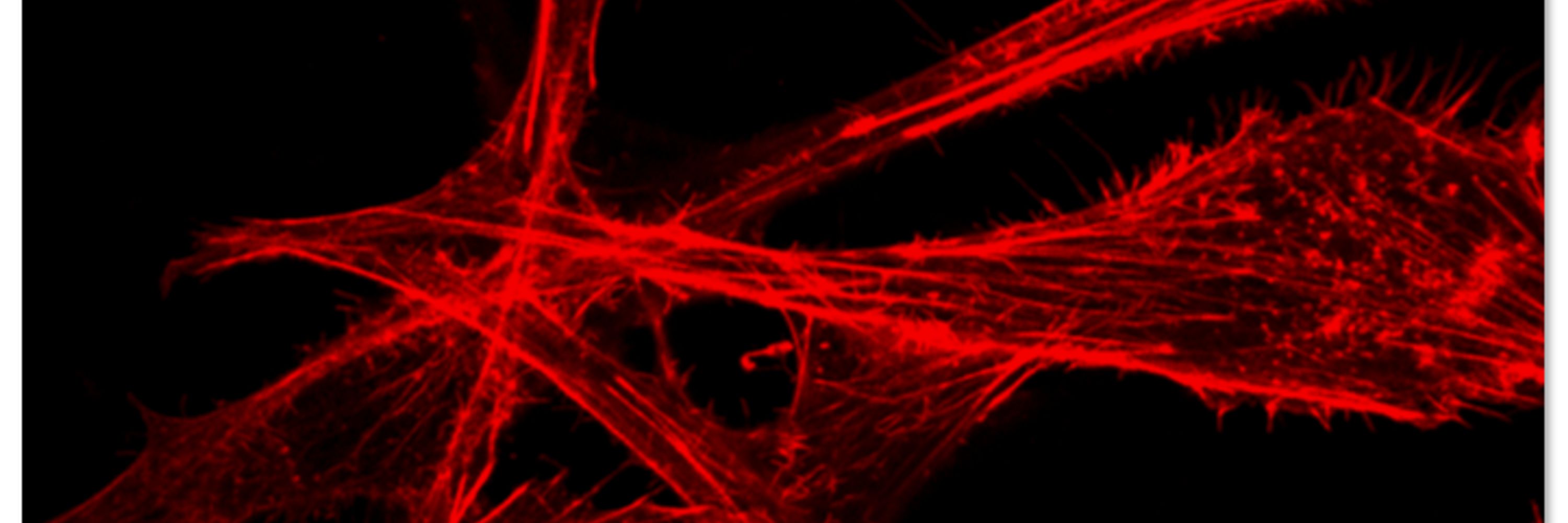 Ischemia