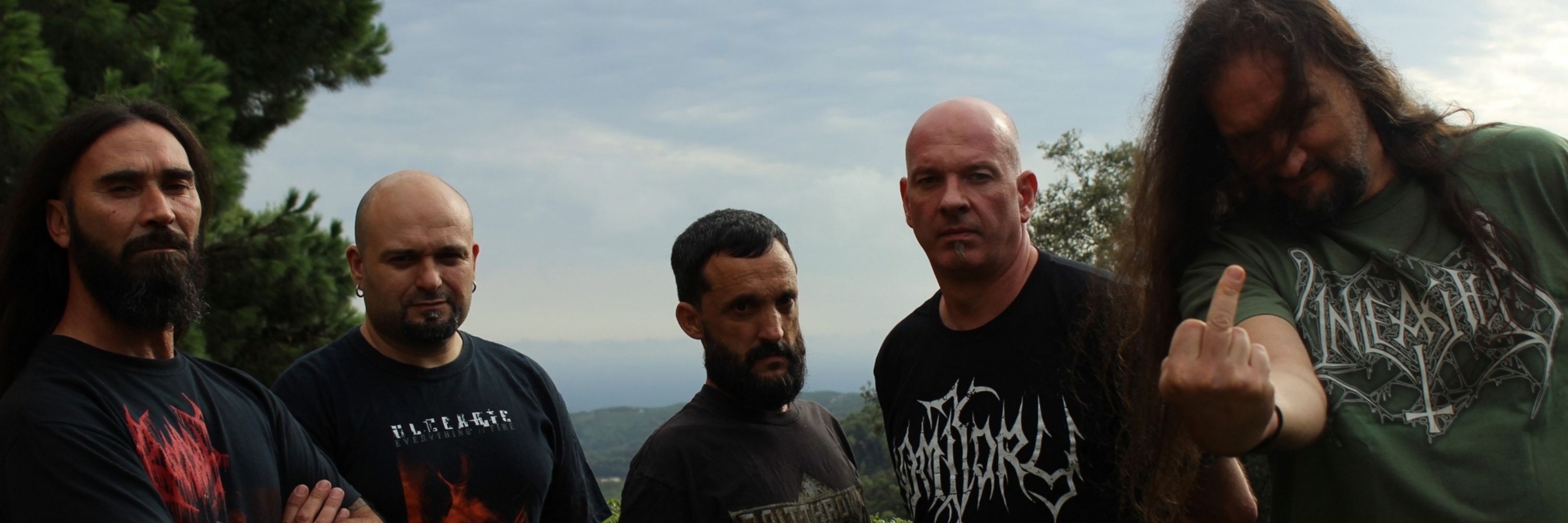 Teratoma