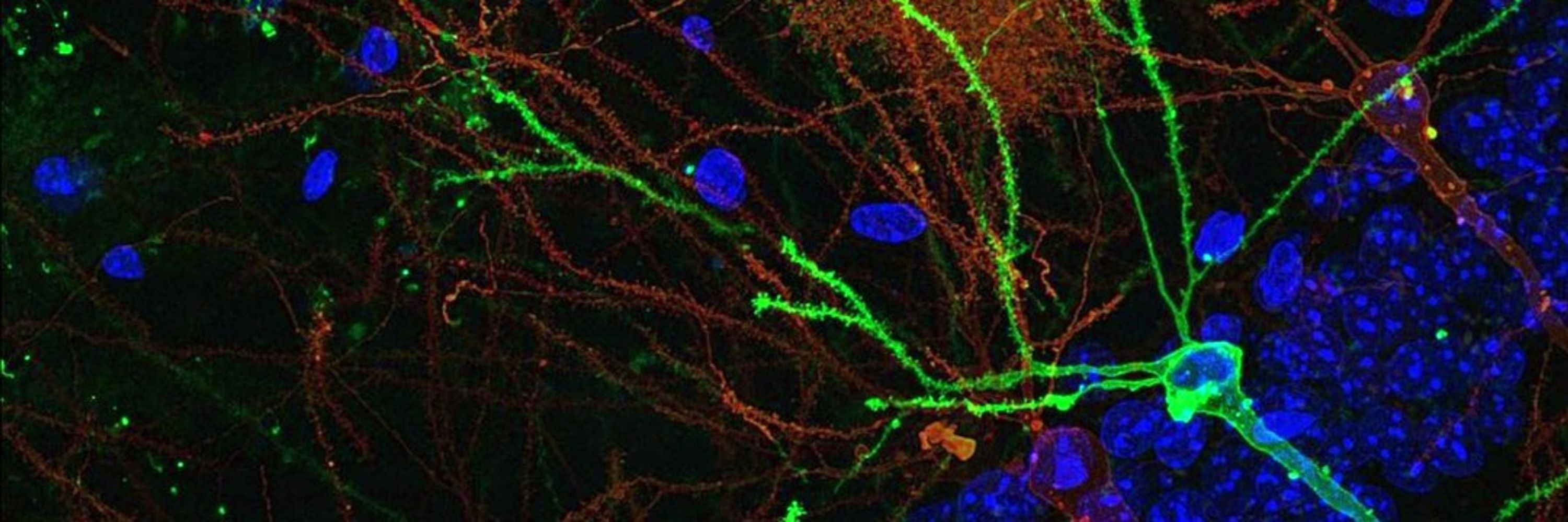 REMOA-Spanish Network for Advanced Microscopy
